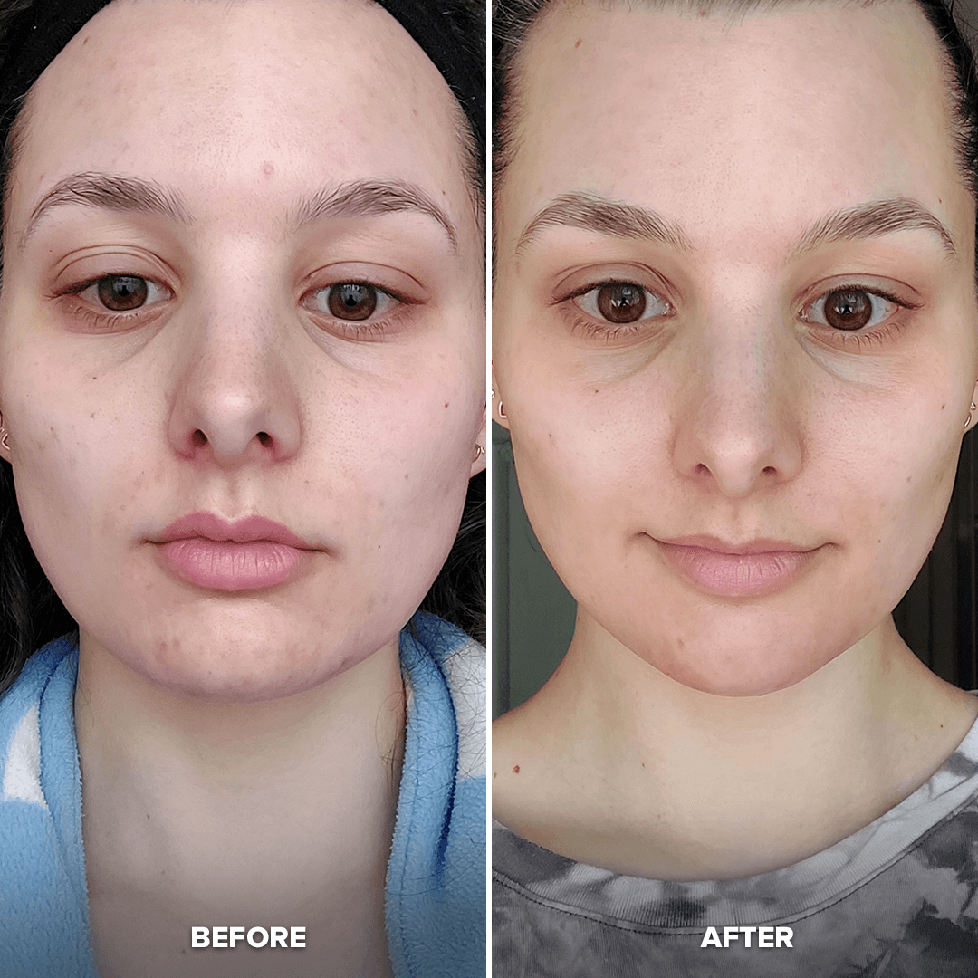 Glow &amp; Go Bundle